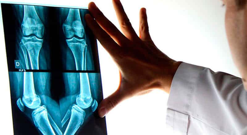Consulta Médica Especializada: El primer paso para recuperar tu movilidad